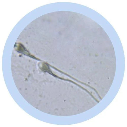 Sperm under microscope