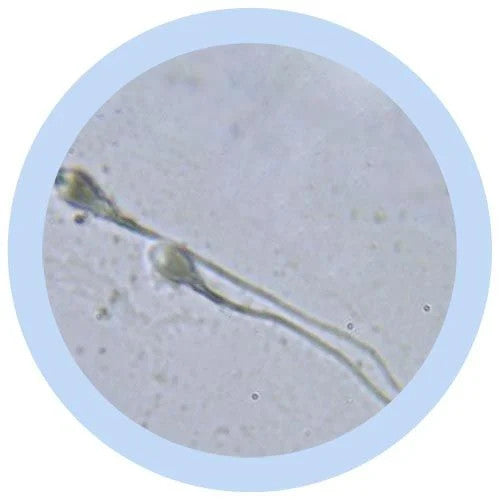 Sperm under microscope