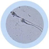 Gigantic Sperm- under microscope