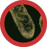 stomach ache/Shigella under the microscope