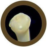 tapeworm/ Taenia ovis under the microscope
