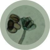 toxic mold/ Stachybotrys chartarum under the microscope