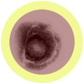 Varicella-Zoster Virus
