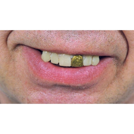 Gold Miner Glow Teeth