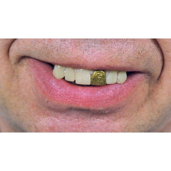 Gold Miner Glow Teeth